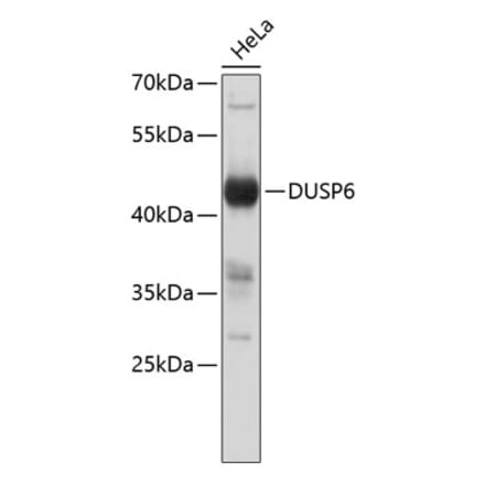Western Blot - Anti-DUSP6 Antibody (A8444) - Antibodies.com