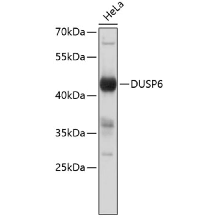 Western Blot - Anti-DUSP6 Antibody (A8444) - Antibodies.com
