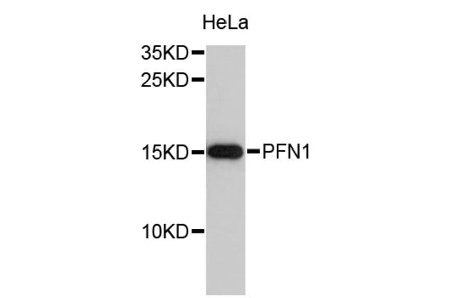 Western Blot - Anti-PFN1 Antibody (A0639) - Antibodies.com