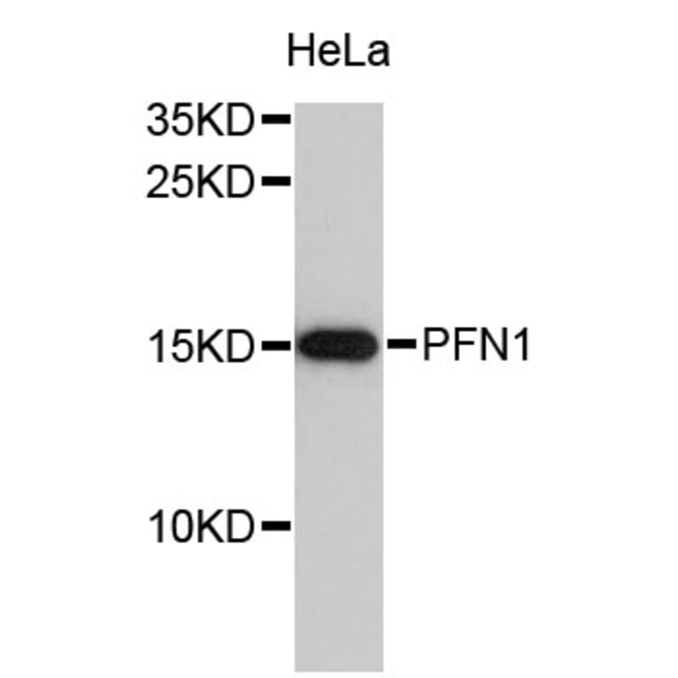 Western Blot - Anti-PFN1 Antibody (A0639) - Antibodies.com