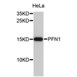 Western Blot - Anti-PFN1 Antibody (A0639) - Antibodies.com