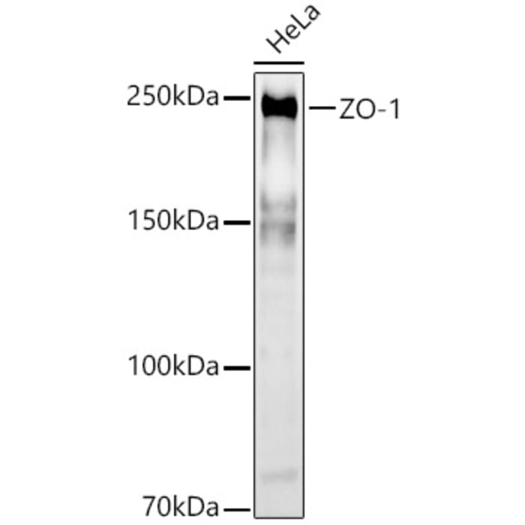 Western Blot - Anti-ZO1 tight junction protein Antibody (A8449) - Antibodies.com