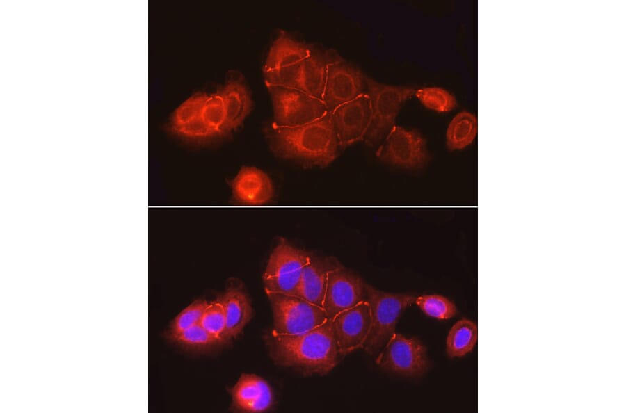 Immunofluorescence - Anti-ZO1 tight junction protein Antibody (A8449) - Antibodies.com
