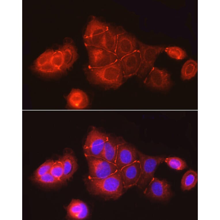 Immunofluorescence - Anti-ZO1 tight junction protein Antibody (A8449) - Antibodies.com