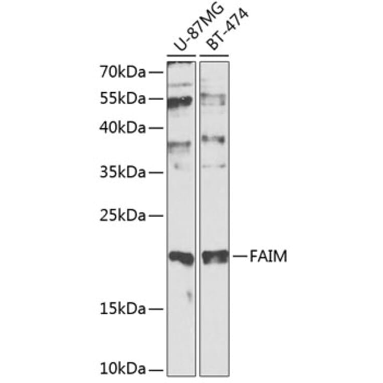 Western Blot - Anti-FAIM Antibody (A0679) - Antibodies.com