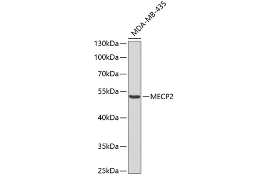 Western Blot - Anti-MECP2 Antibody (A0706) - Antibodies.com