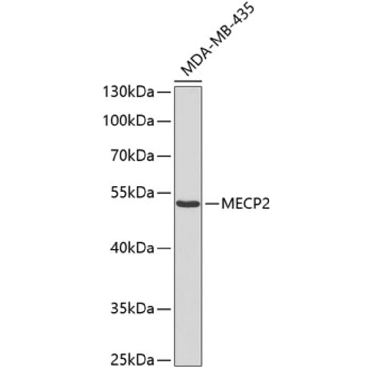 Western Blot - Anti-MECP2 Antibody (A0706) - Antibodies.com