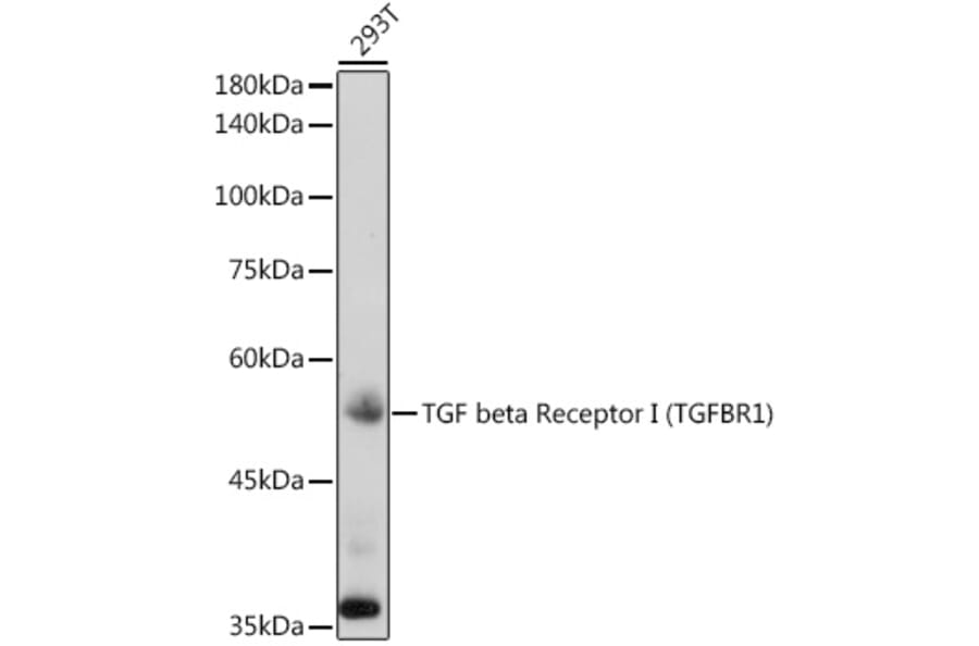Western Blot - Anti-TGF beta Receptor I Antibody (A8453) - Antibodies.com