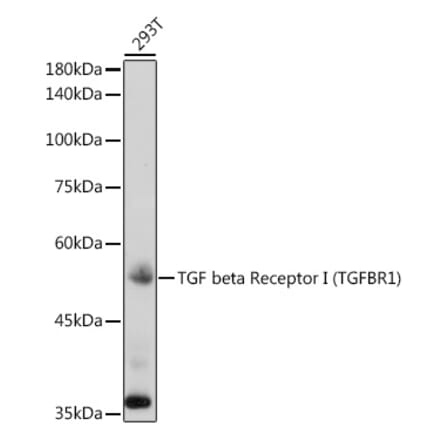 Western Blot - Anti-TGF beta Receptor I Antibody (A8453) - Antibodies.com