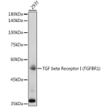 Western Blot - Anti-TGF beta Receptor I Antibody (A8453) - Antibodies.com