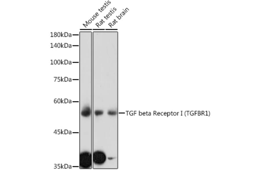 Western Blot - Anti-TGF beta Receptor I Antibody (A8453) - Antibodies.com