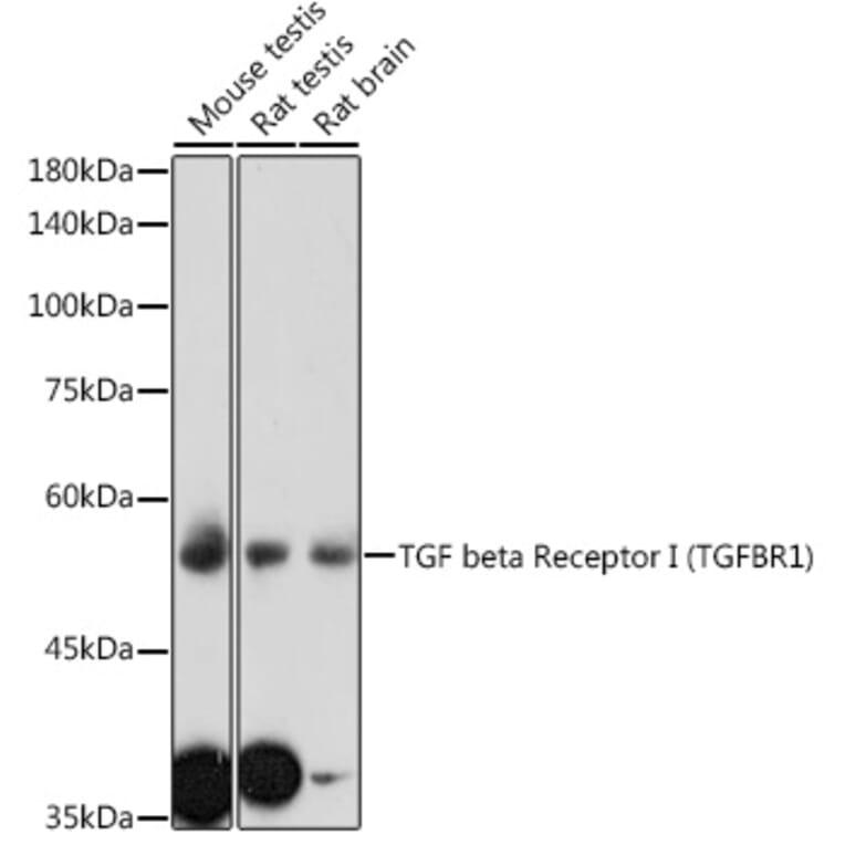 Western Blot - Anti-TGF beta Receptor I Antibody (A8453) - Antibodies.com