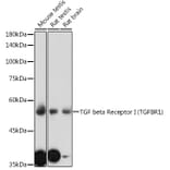 Western Blot - Anti-TGF beta Receptor I Antibody (A8453) - Antibodies.com