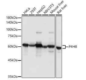 Western Blot - Anti-P4HB Antibody (A8454) - Antibodies.com