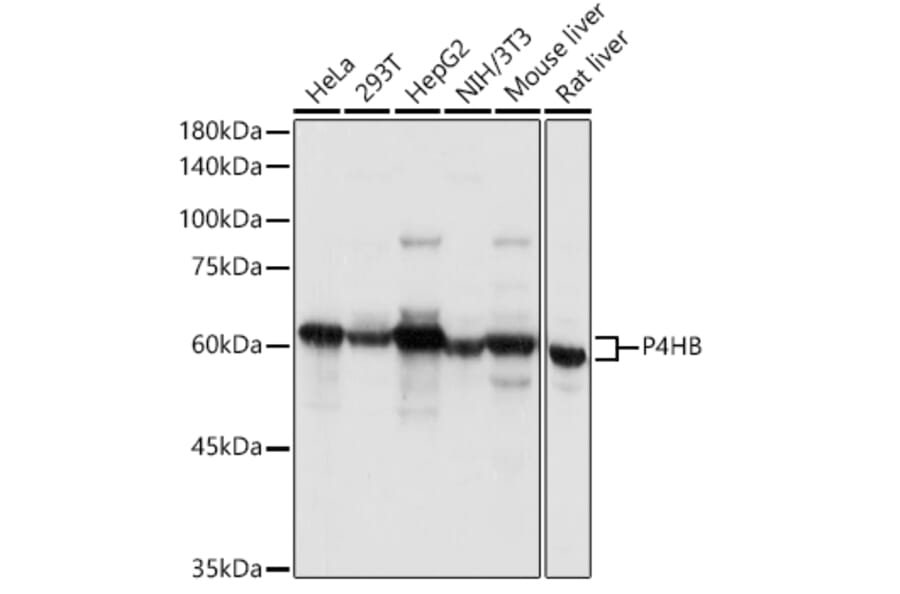 Western Blot - Anti-P4HB Antibody (A8454) - Antibodies.com