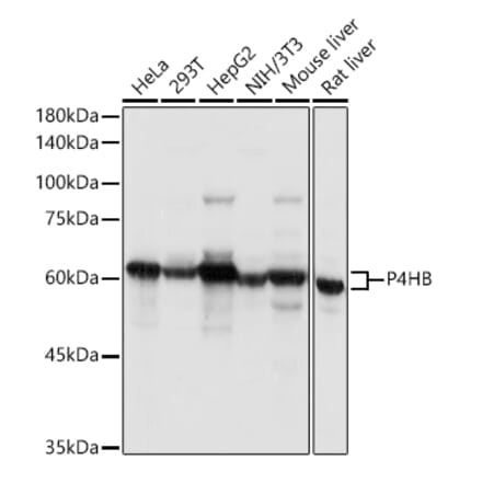 Western Blot - Anti-P4HB Antibody (A8454) - Antibodies.com