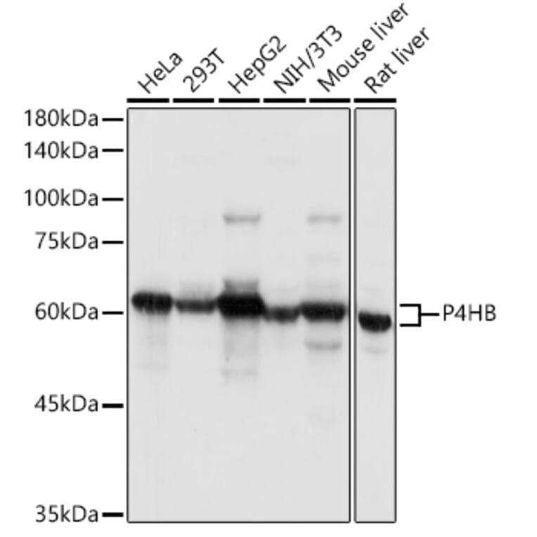 Western Blot - Anti-P4HB Antibody (A8454) - Antibodies.com