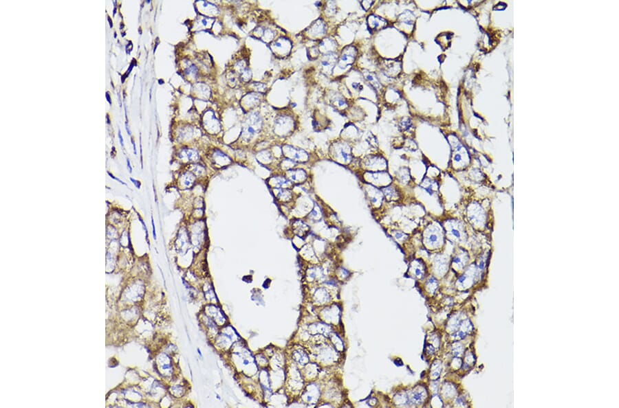 Immunohistochemistry - Anti-P4HB Antibody (A8454) - Antibodies.com