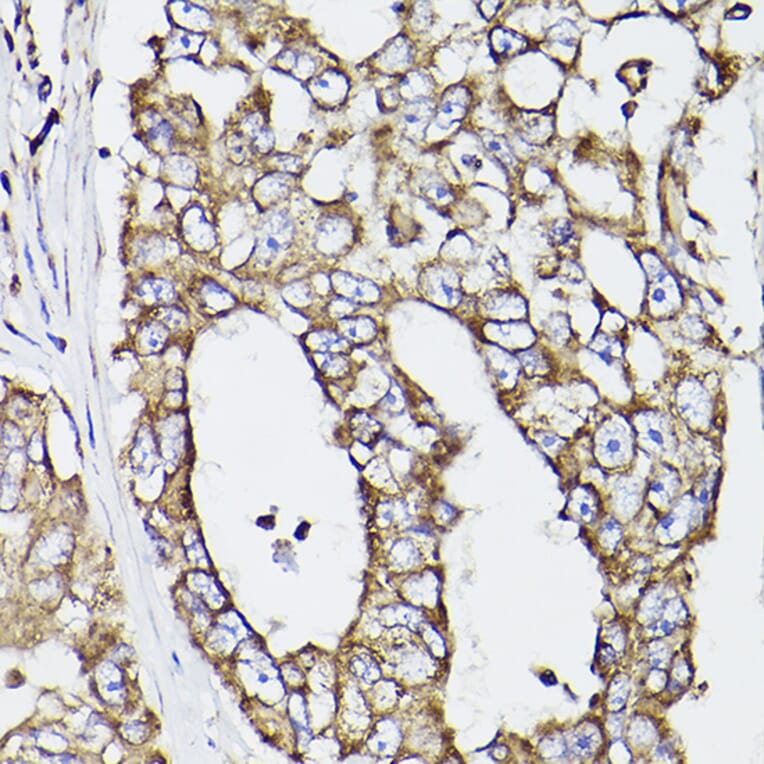 Immunohistochemistry - Anti-P4HB Antibody (A8454) - Antibodies.com