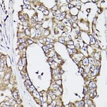 Immunohistochemistry - Anti-P4HB Antibody (A8454) - Antibodies.com