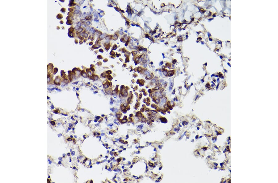 Immunohistochemistry - Anti-P4HB Antibody (A8454) - Antibodies.com