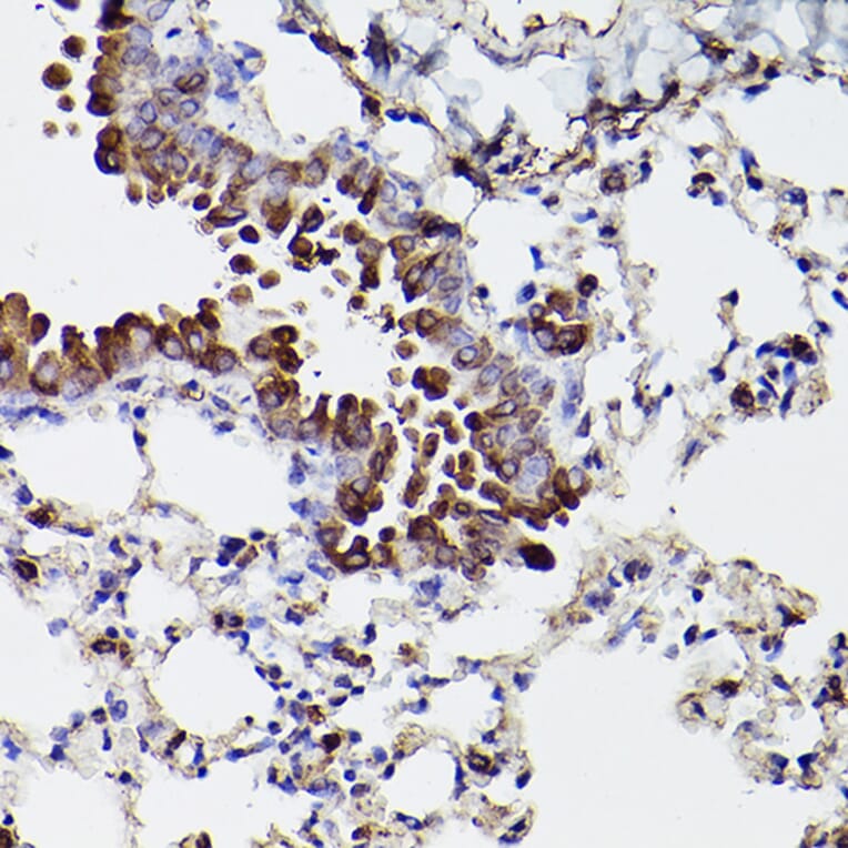 Immunohistochemistry - Anti-P4HB Antibody (A8454) - Antibodies.com