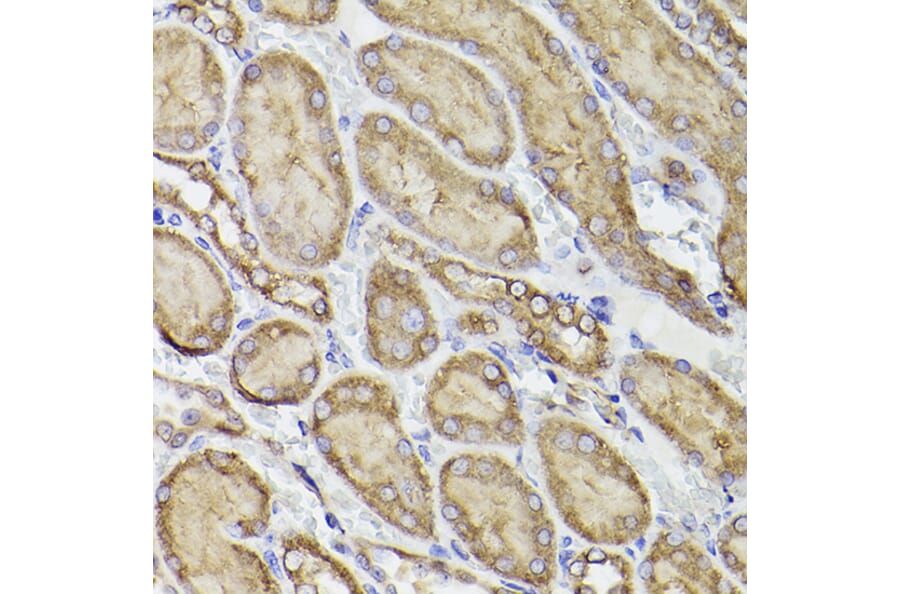 Immunohistochemistry - Anti-P4HB Antibody (A8454) - Antibodies.com