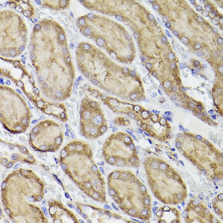 Immunohistochemistry - Anti-P4HB Antibody (A8454) - Antibodies.com