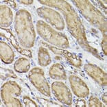 Immunohistochemistry - Anti-P4HB Antibody (A8454) - Antibodies.com