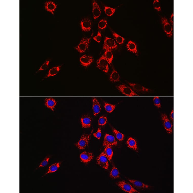 Immunofluorescence - Anti-P4HB Antibody (A8454) - Antibodies.com