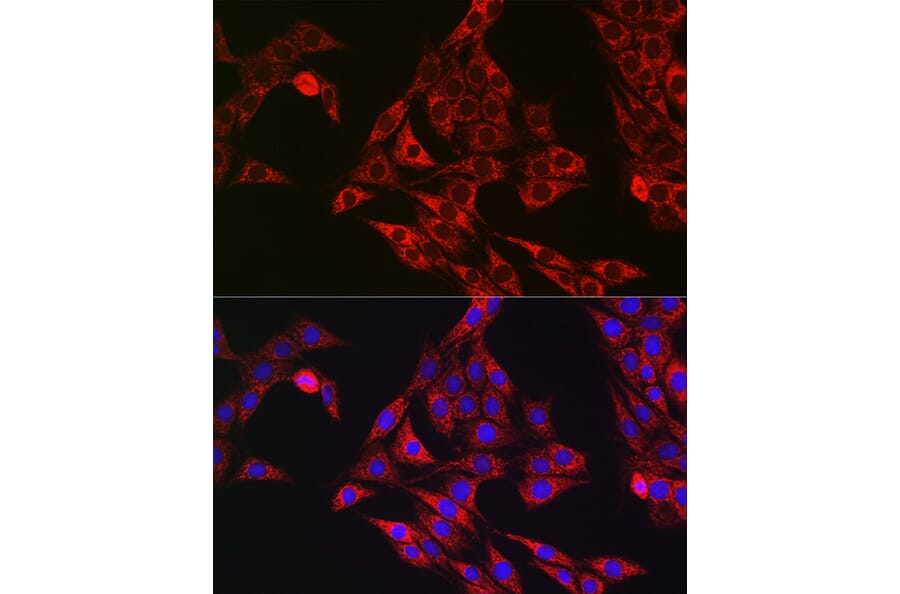 Immunofluorescence - Anti-P4HB Antibody (A8454) - Antibodies.com