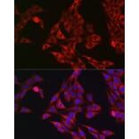 Immunofluorescence - Anti-P4HB Antibody (A8454) - Antibodies.com