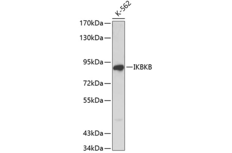 Western Blot - Anti-IKBKB Antibody (A0713) - Antibodies.com