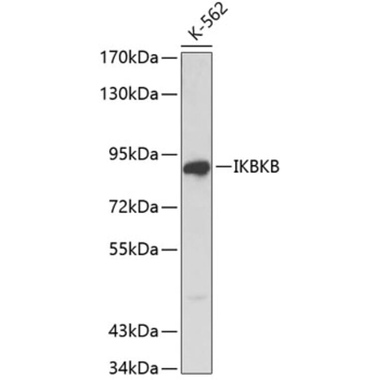 Western Blot - Anti-IKBKB Antibody (A0713) - Antibodies.com
