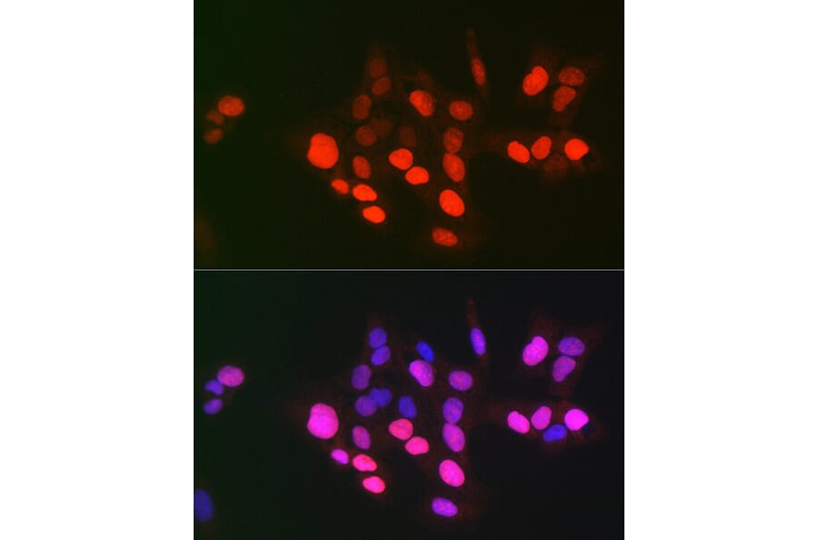 Immunofluorescence - Anti-Topoisomerase II alpha Antibody (A8458) - Antibodies.com