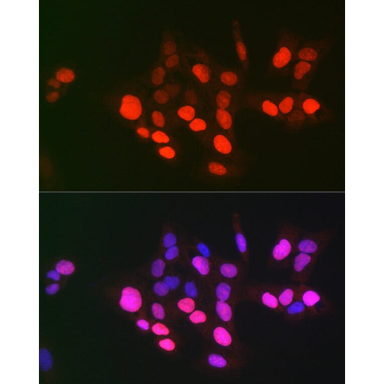 Immunofluorescence - Anti-Topoisomerase II alpha Antibody (A8458) - Antibodies.com