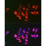 Immunofluorescence - Anti-Topoisomerase II alpha Antibody (A8458) - Antibodies.com