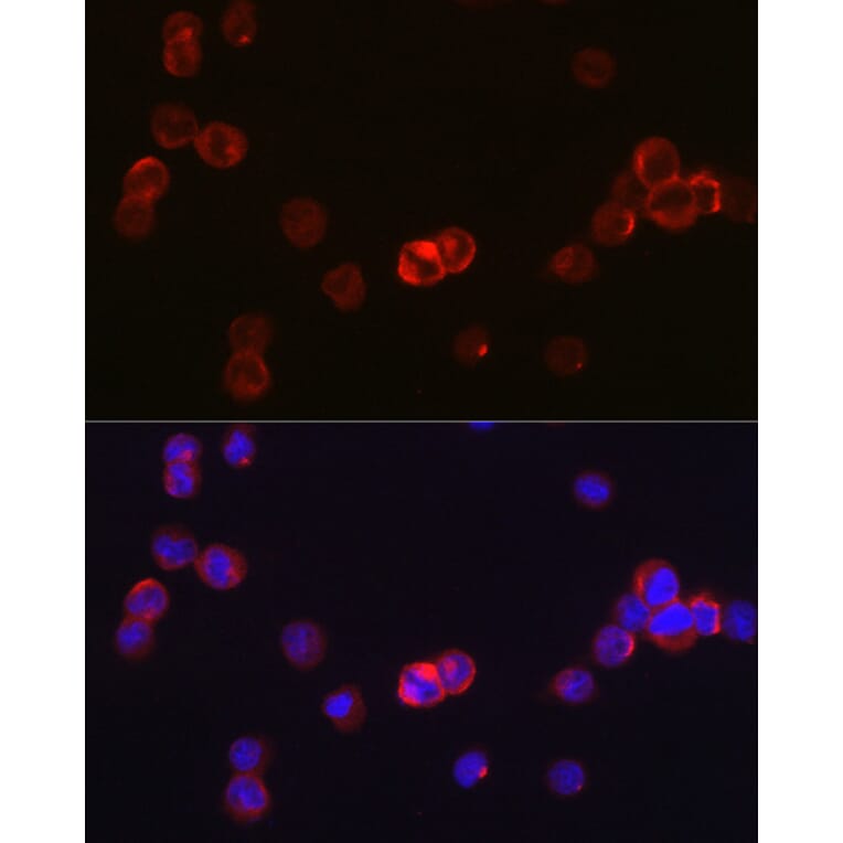 Immunofluorescence - Anti-JAK3 Antibody (A8460) - Antibodies.com
