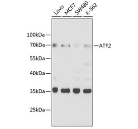 Western Blot - Anti-ATF2 Antibody (A8461) - Antibodies.com