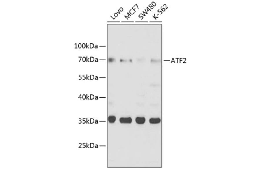 Western Blot - Anti-ATF2 Antibody (A8461) - Antibodies.com