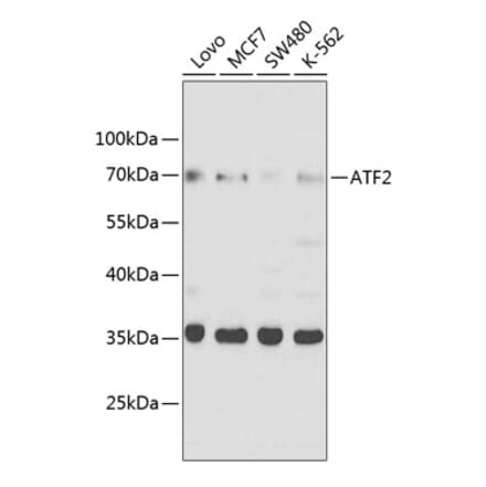 Western Blot - Anti-ATF2 Antibody (A8461) - Antibodies.com