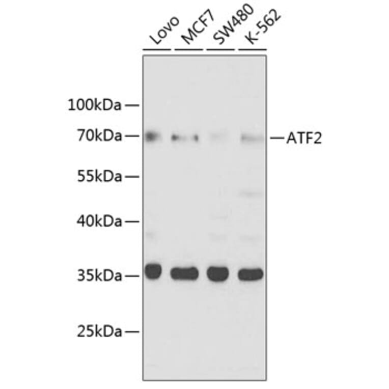 Western Blot - Anti-ATF2 Antibody (A8461) - Antibodies.com