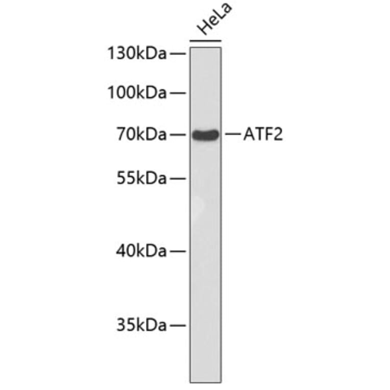 Western Blot - Anti-ATF2 Antibody (A8461) - Antibodies.com