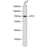 Western Blot - Anti-ATF2 Antibody (A8461) - Antibodies.com