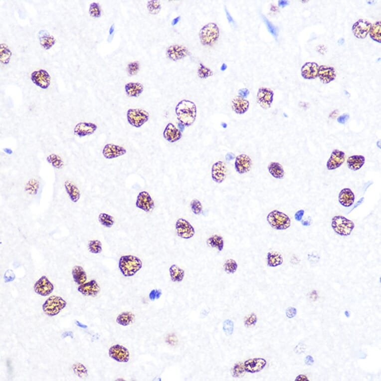 Immunohistochemistry - Anti-ATF2 Antibody (A8461) - Antibodies.com