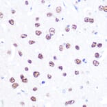 Immunohistochemistry - Anti-ATF2 Antibody (A8461) - Antibodies.com