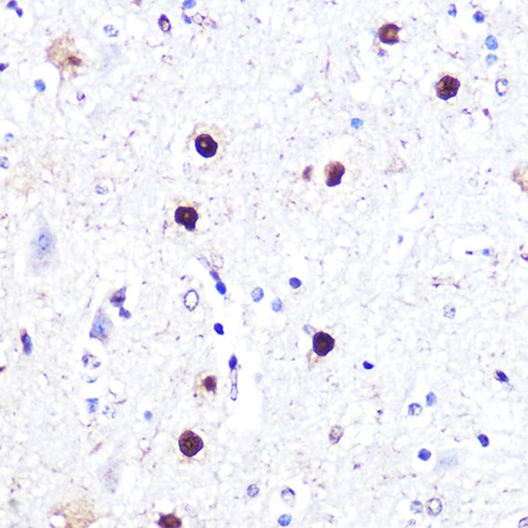 Immunohistochemistry - Anti-ATF2 Antibody (A8461) - Antibodies.com