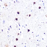 Immunohistochemistry - Anti-ATF2 Antibody (A8461) - Antibodies.com