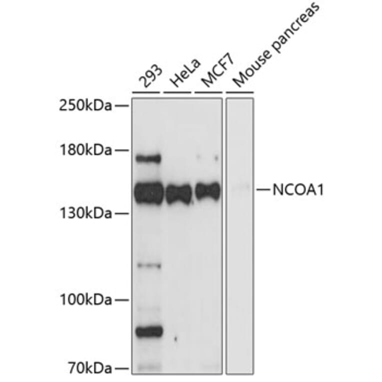 Western Blot - Anti-NCOA1 Antibody (A0765) - Antibodies.com