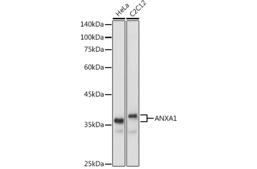 Western Blot - Anti-Annexin A1/ANXA1 Antibody (A8466) - Antibodies.com